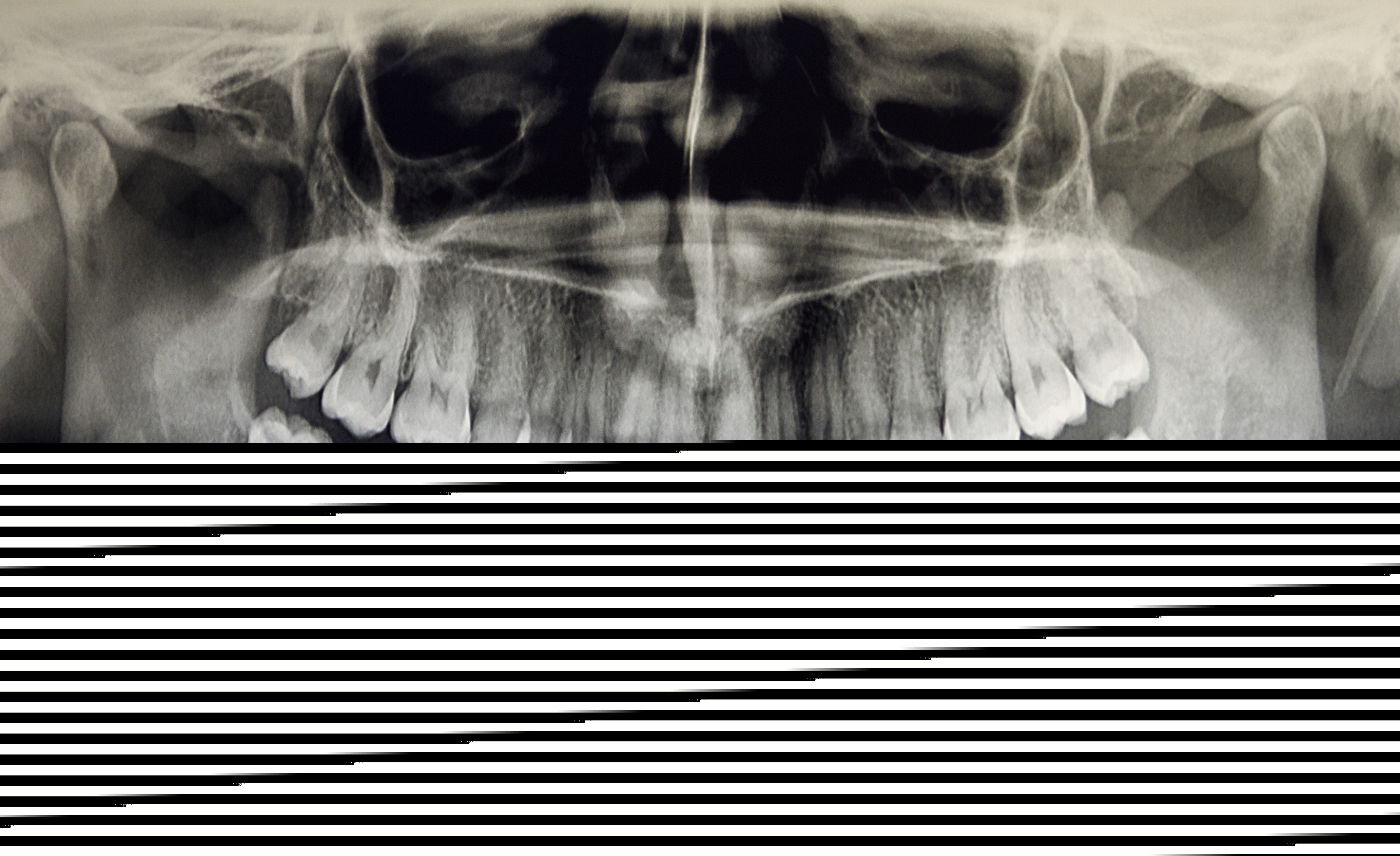 dental x-ray